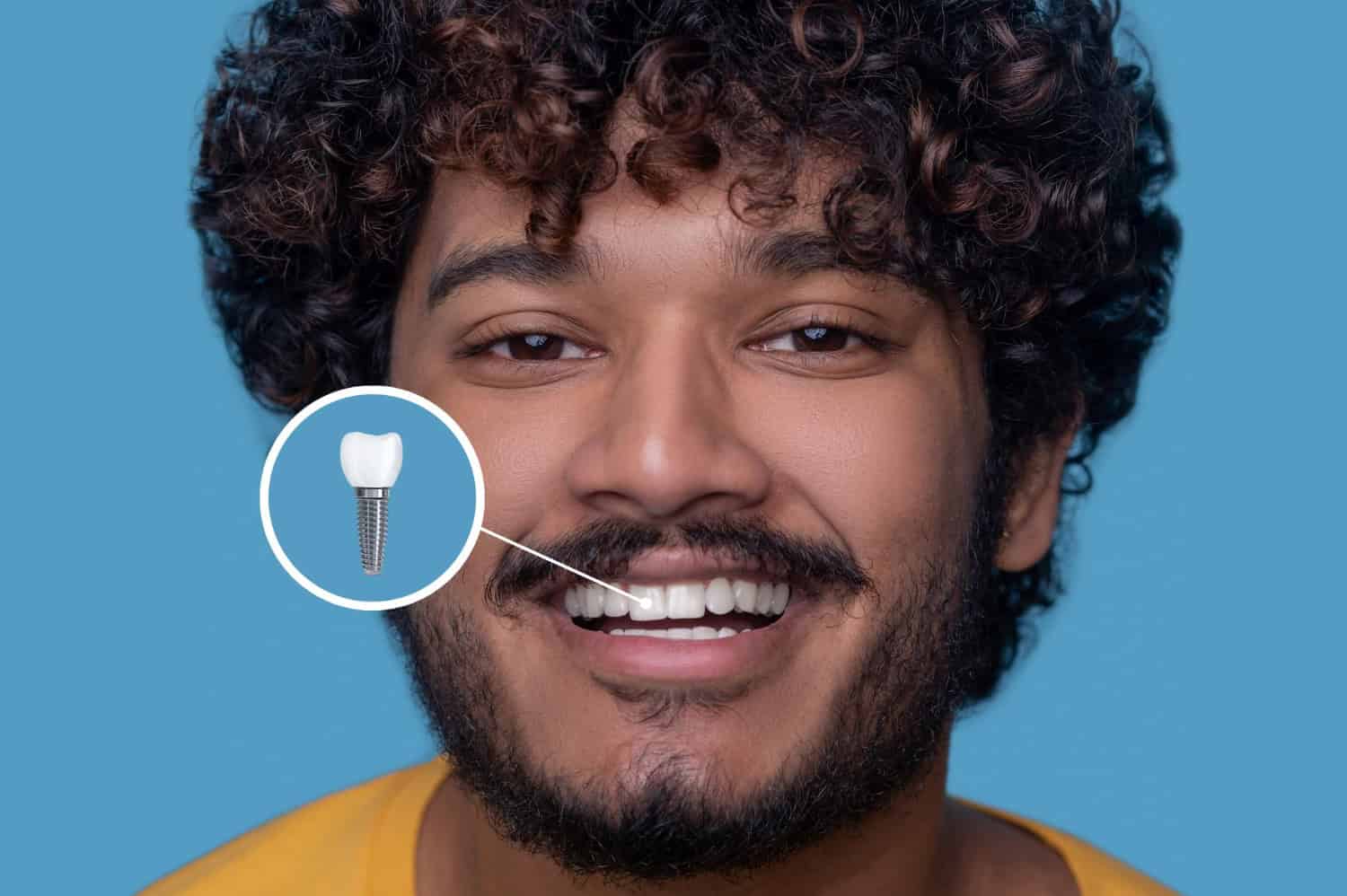 same day dental implants